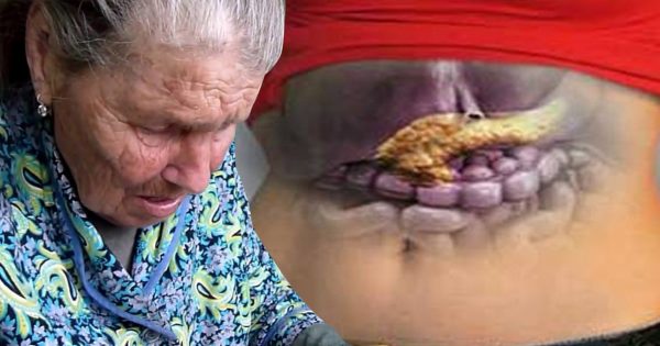 Бабушка лечение поджелудочной железы thumbnail