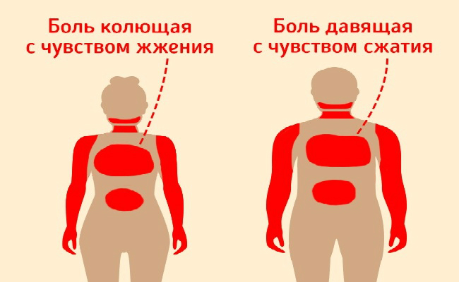 Колющие боли форум. Колющая боль. Колющие боли. Здесь болит колет.