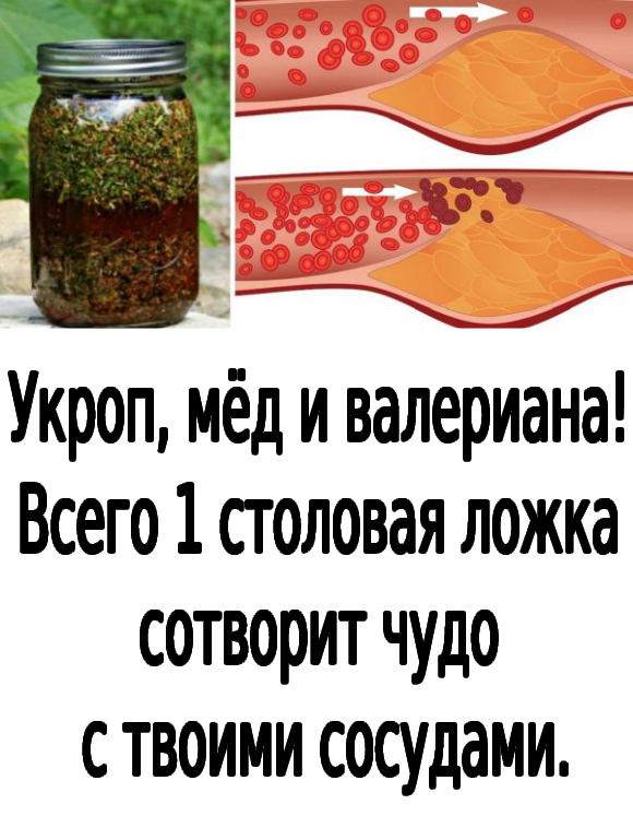 Укроп, мёд и валериана! Всего 1 столовая ложка сотворит чудо с твоими сосудами.