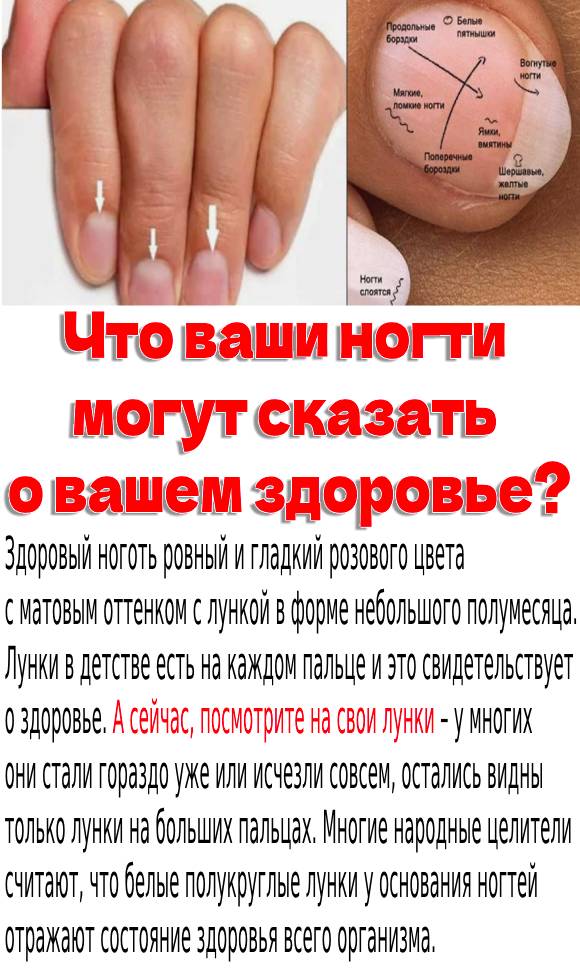 Что ваши ногти могут сказать о вашем здоровье?