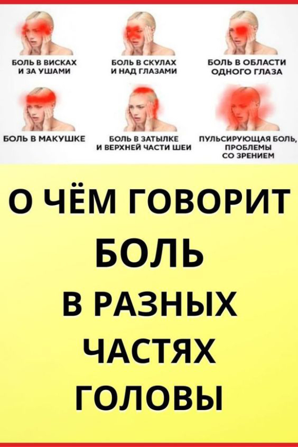 О чем говорит боль в разных частях головы