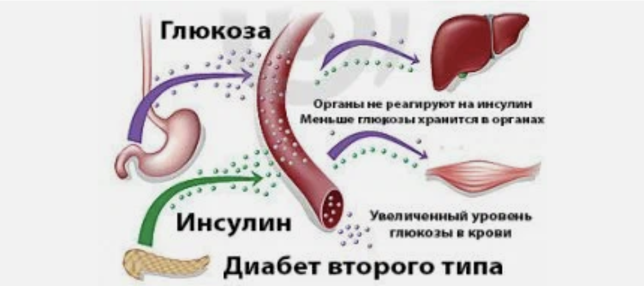 Древний рецепт поможет держать сахар в норме. Или как вылечить сахарный диабет