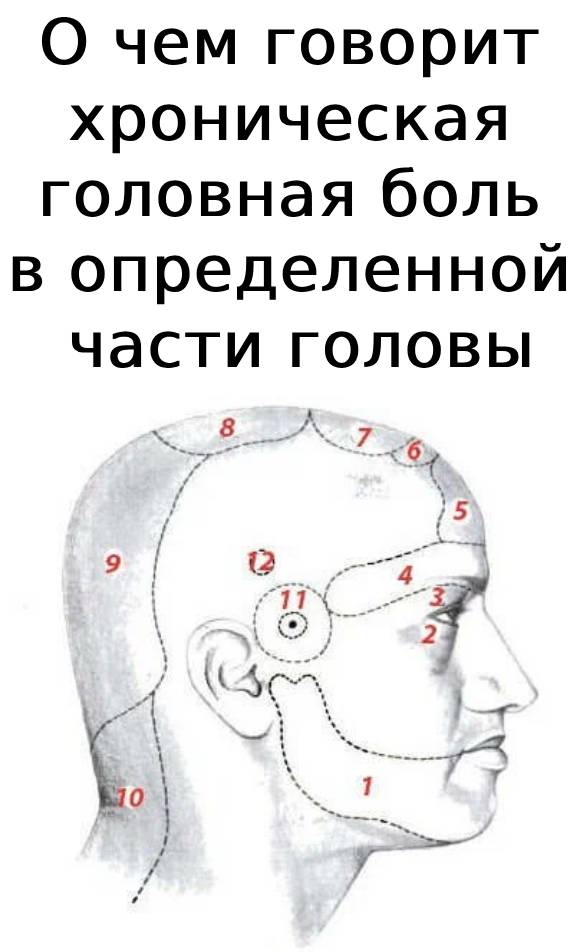 О чем говорит хроническая головная боль в определенной части головы